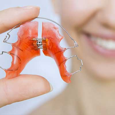 شکستن یا گم کردن پلاک متحرک ارتودنسی