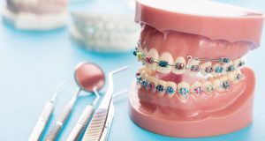 ابزار ارتودنسی