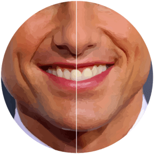 انحراف میدلاین