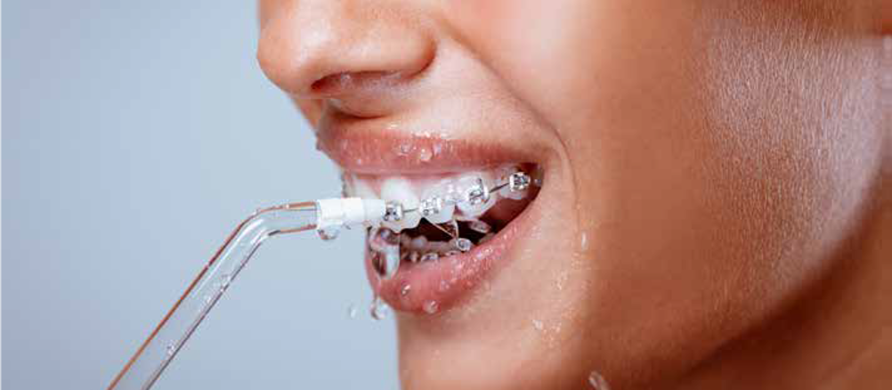 بهداشت ارتودنسی