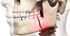 جراحی فک و صورت