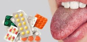 علت و درمان خشکی دهان