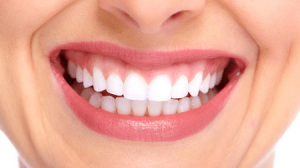 درمان لبخند لثه ای