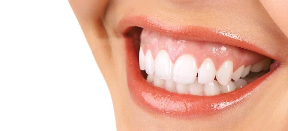 درمان لبخند لثه ای