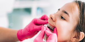 دندان میخی شکل