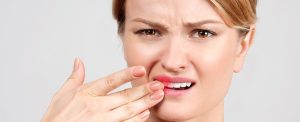 فلوراید تراپی