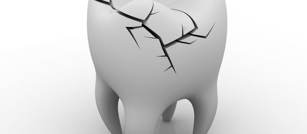 لب پریدگی دندان