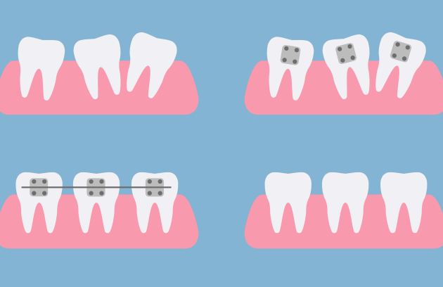 مراحل ارتودنسی