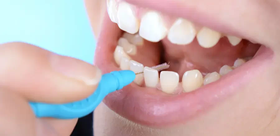 مسواک بین دندانی