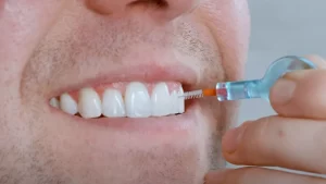 مسواک بین دندانی