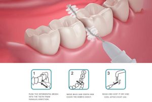مسواک بین دندانی
