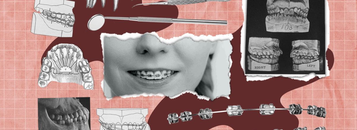 عوارض درمان ارتودنسی