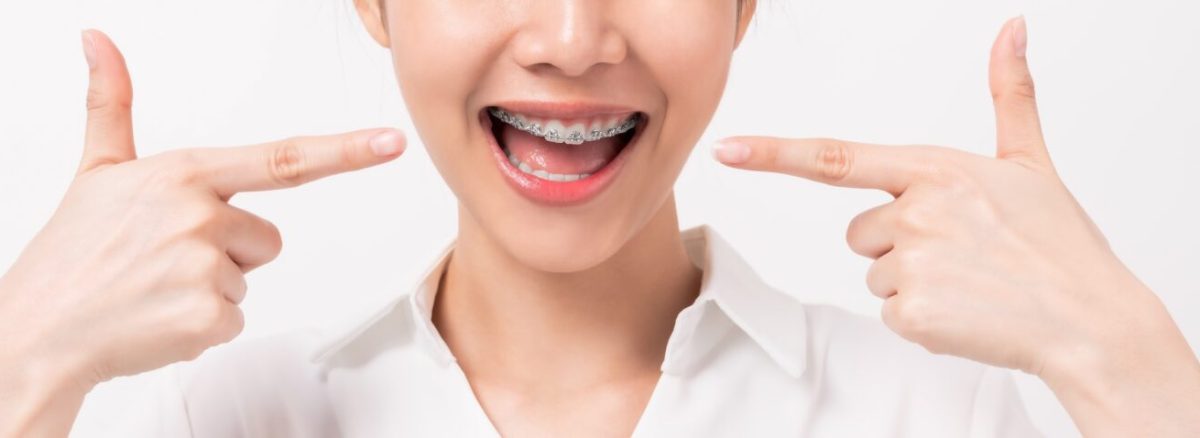 ارتودنسی زودبازده