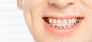 بهترین متخصص ارتودنسی