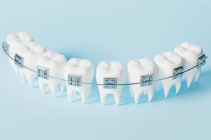 مزایای ارتودنسی