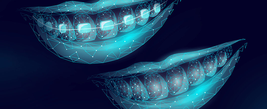 مزایای ارتودنسی