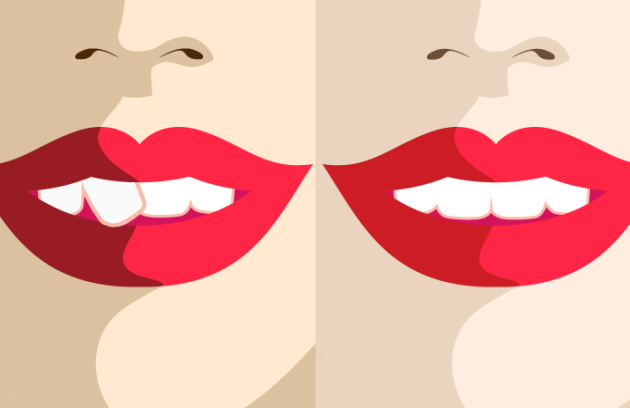 ارتودنسی تک دندان