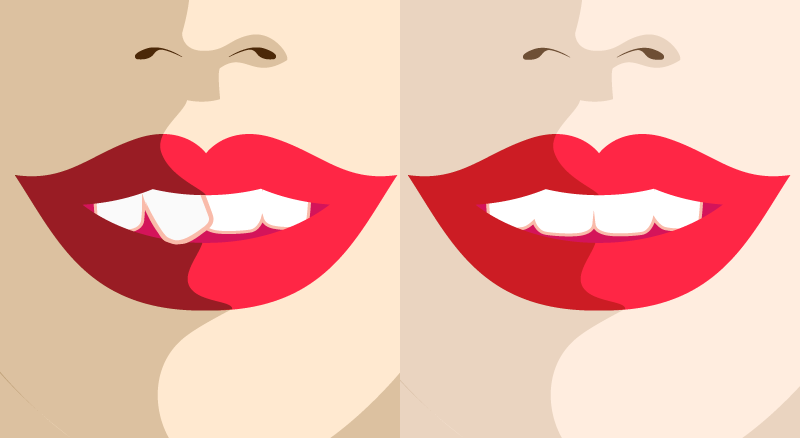 ارتودنسی تک دندان