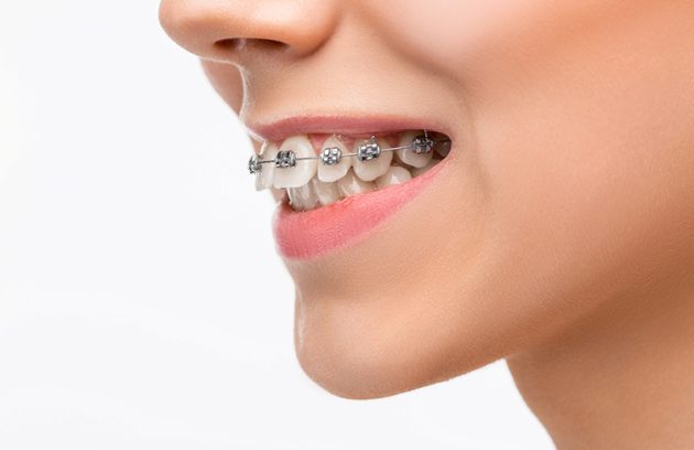 ارتودنسی تک فک