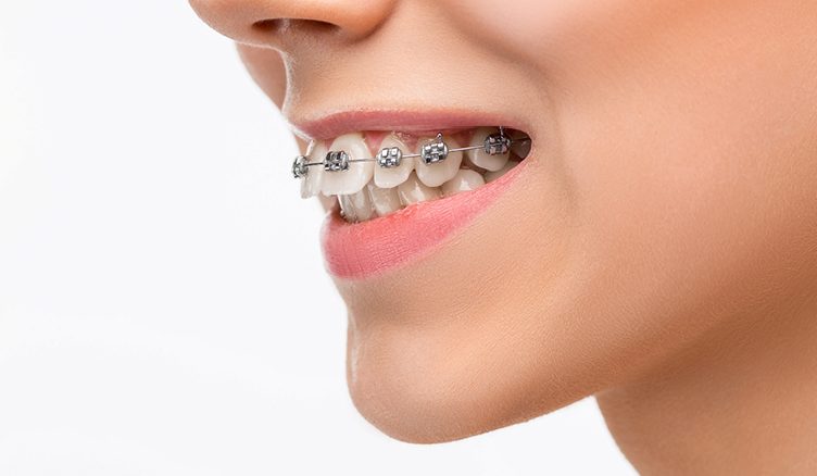 ارتودنسی تک فک