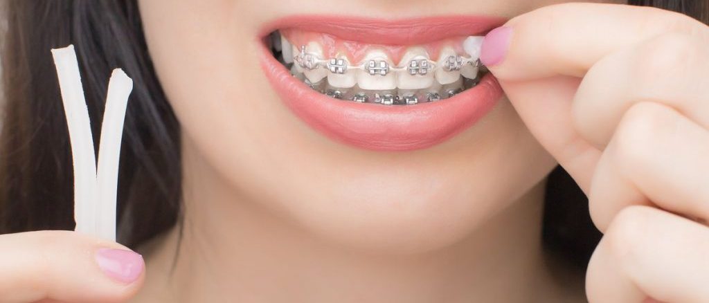 موم ارتودنسی