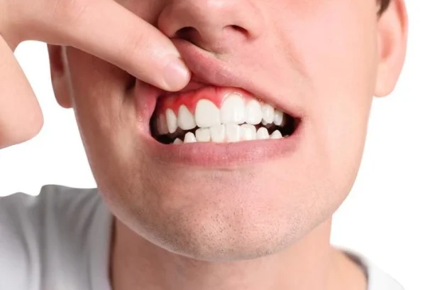 پریودنتیست یا متخصص لثه