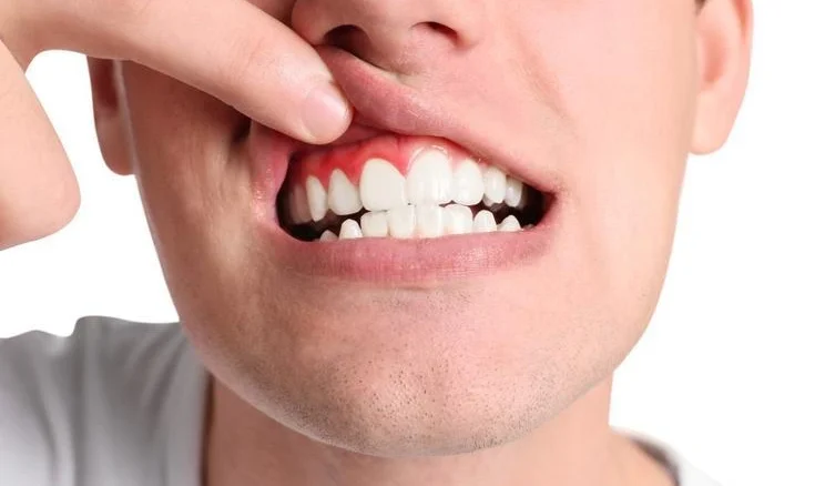 پریودنتیست یا متخصص لثه