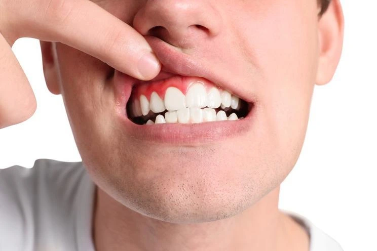 پریودنتیست یا متخصص لثه