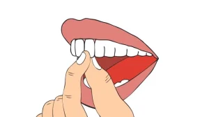 لق شدن دندان دائمی
