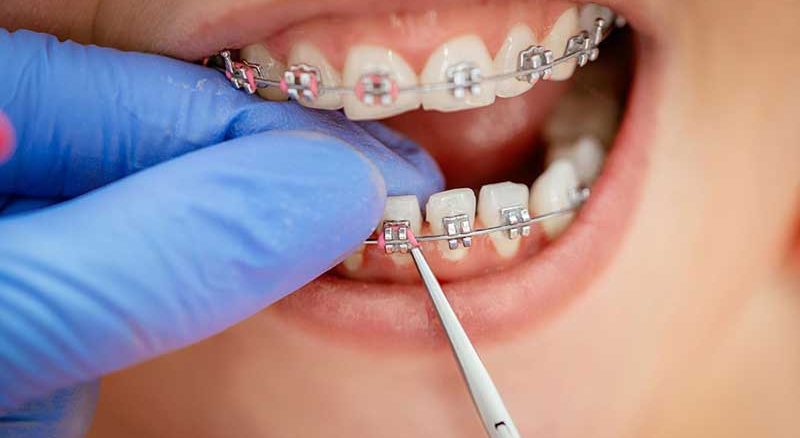 ارتودنسی اقساطی دکتر مهدیه خسروی