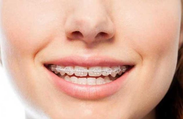 ارتودنسی زود بازده خوب است یا بد