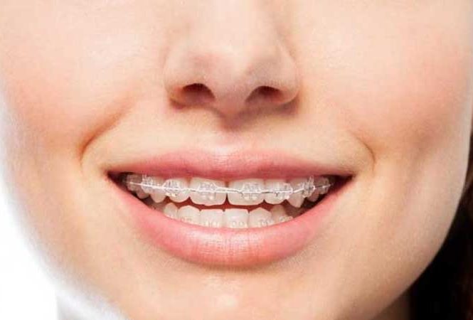 ارتودنسی زود بازده خوب است یا بد