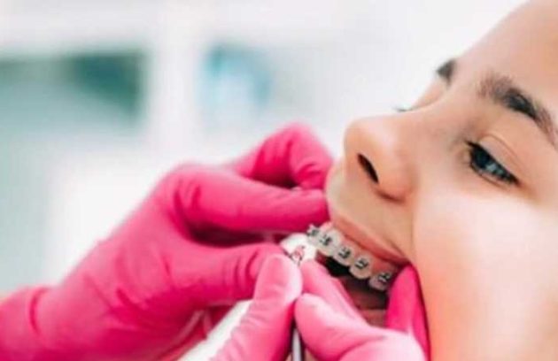 بهترین متخصص ارتودنسی کودکان در تهران قلهک