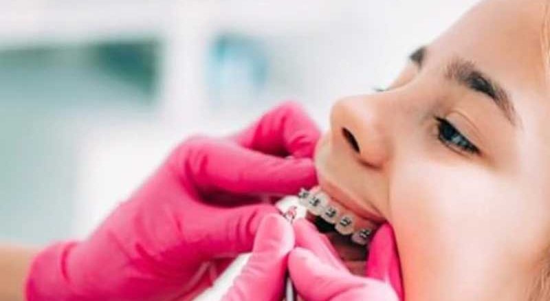 بهترین متخصص ارتودنسی کودکان در تهران قلهک