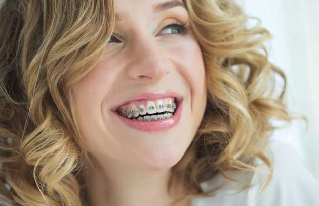 تا چند سالگی می توان ارتودنسی کرد؟