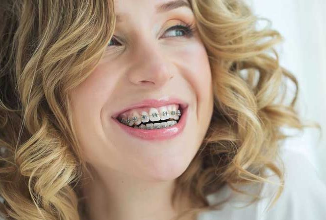 تا چند سالگی می توان ارتودنسی کرد؟