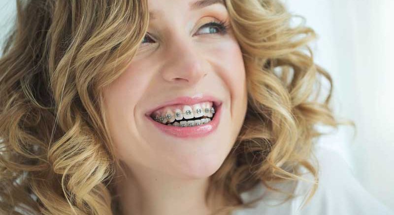 تا چند سالگی می توان ارتودنسی کرد؟