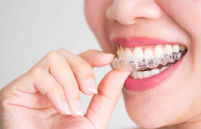 ارتودنسی اقساطی دکتر مهدیه خسروی