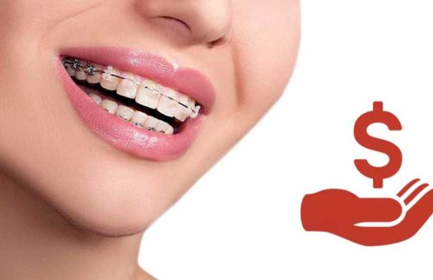 ارتودنسی اقساطی در تهران