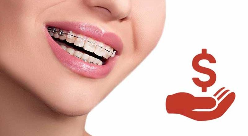 ارتودنسی اقساطی در تهران