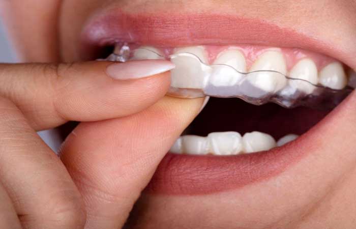 متخصص ارتودنسی خانم دکتر مهدیه خسروی تهران