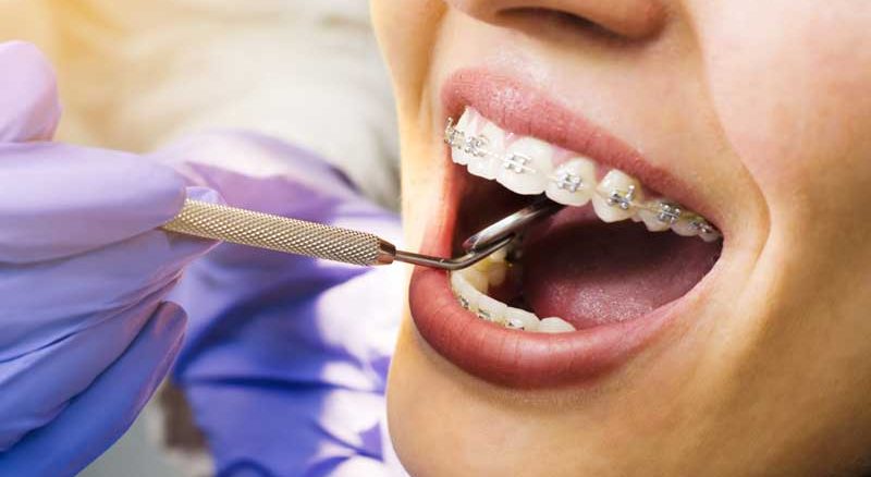 متخصص ارتودنسی خانم دکتر مهدیه خسروی تهران