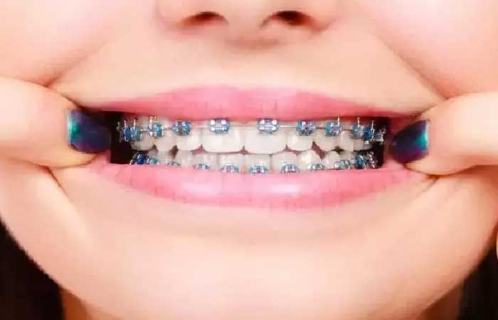 متخصص ارتودنسی خانم دکتر مهدیه خسروی تهران