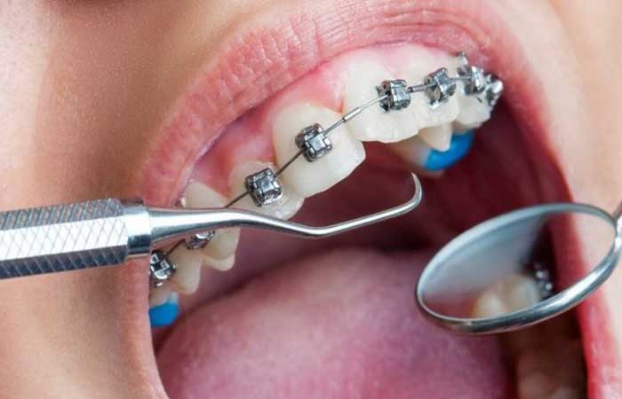 ارتودنسی اقساطی دکتر مهدیه خسروی