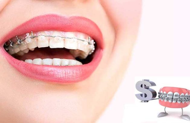 شرایط بیمه ارتودنسی تکمیلی