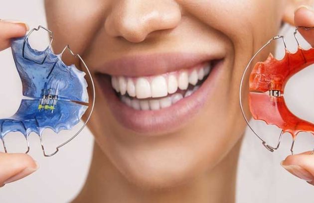 قیمت ارتودنسی متحرک دو فک