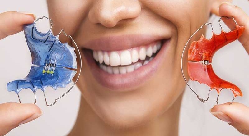 قیمت ارتودنسی متحرک دو فک