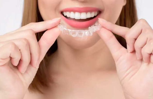 انواع ارتودنسی متحرک