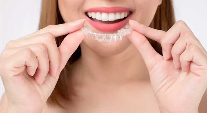 انواع ارتودنسی متحرک