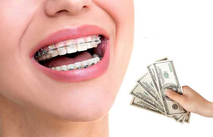 شرایط بیمه ارتودنسی تکمیلی